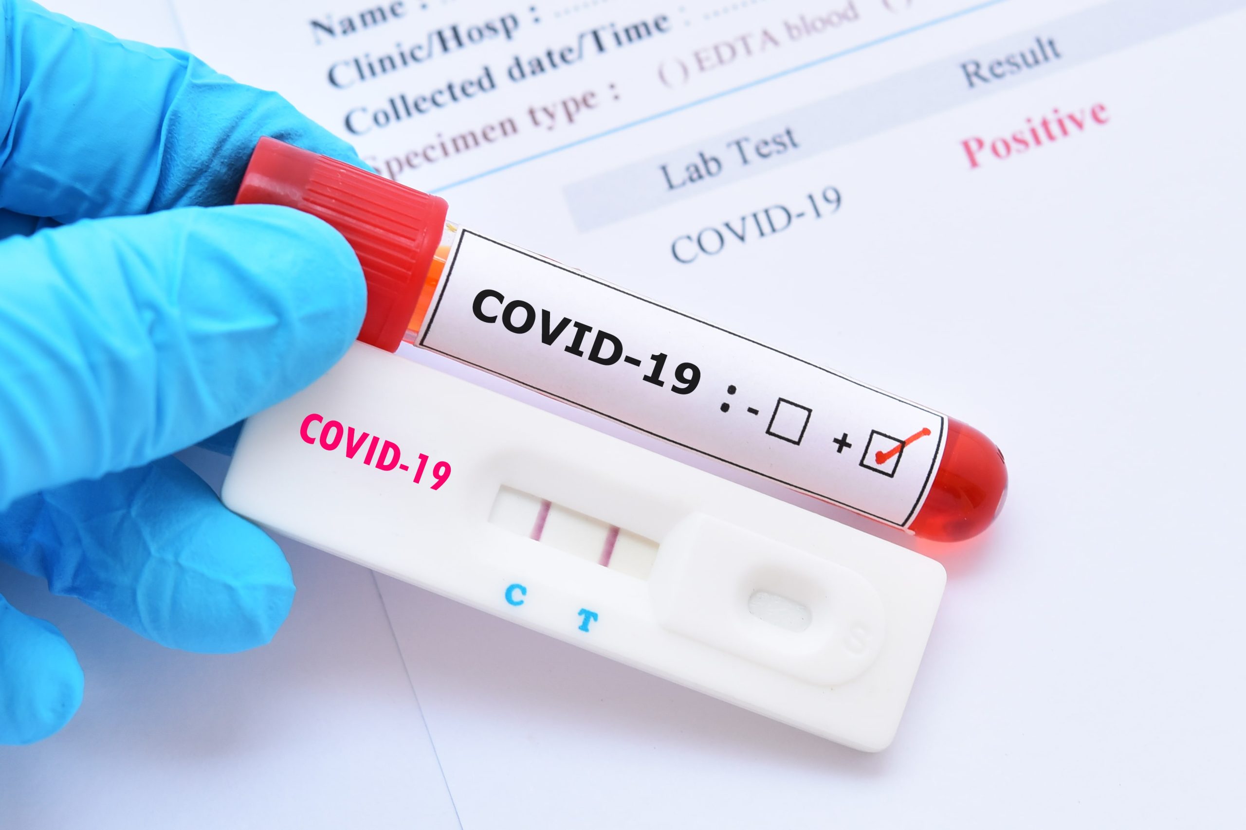 IR 2021: teste da COVID-19 faz parte das declarações médicas? Confira!